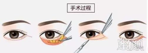 https://img.miyanlife.com/mnt/timg/180902/11515a919-14.jpg