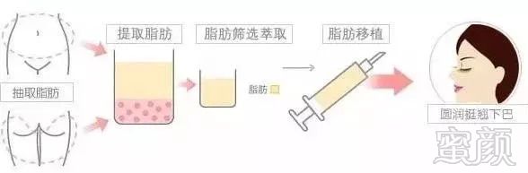 https://img.miyanlife.com/mnt/timg/180902/12102K5V-5.jpg