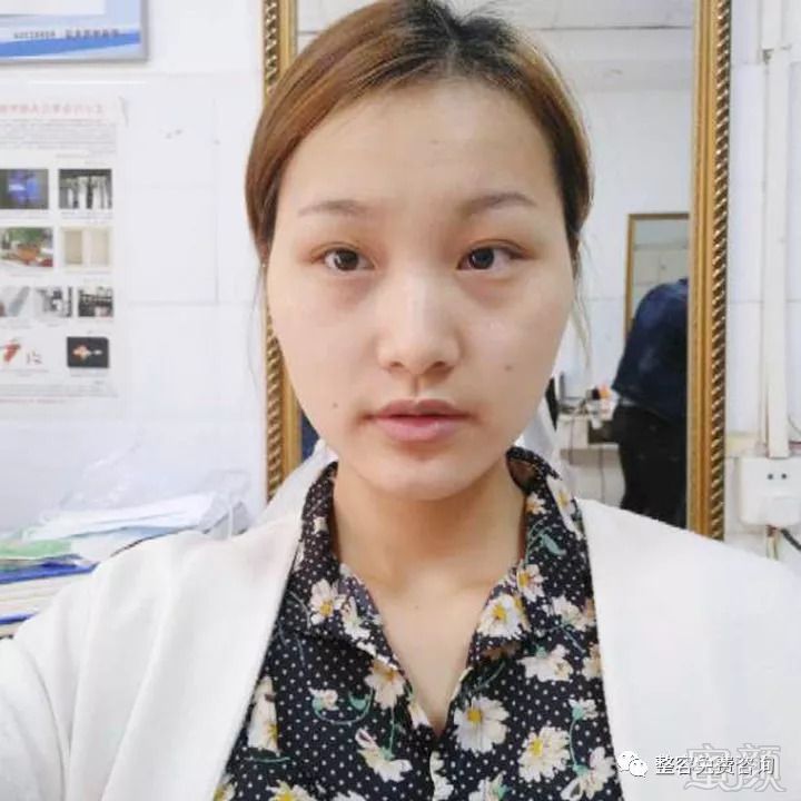 https://img.miyanlife.com/mnt/timg/180902/1211463424-0.jpg