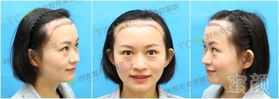 https://img.miyanlife.com/mnt/timg/180902/1233303I0-2.jpg