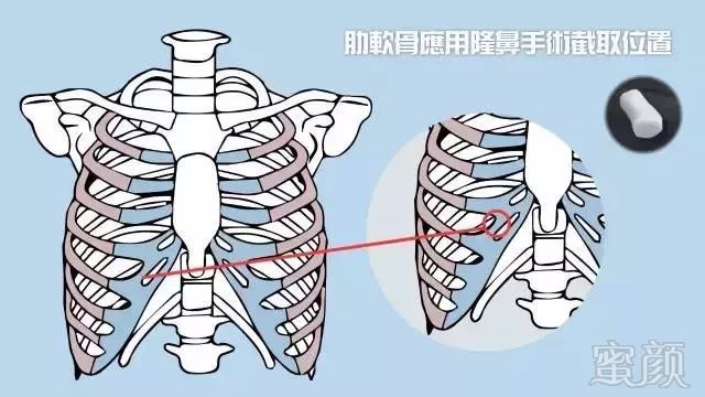 https://img.miyanlife.com/mnt/timg/180902/123429B07-8.jpg