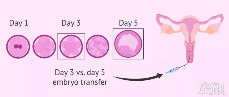 https://img.miyanlife.com/mnt/timg/180902/12363T5A-10.jpg