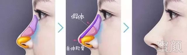 https://img.miyanlife.com/mnt/timg/180902/123Q4G23-4.jpg