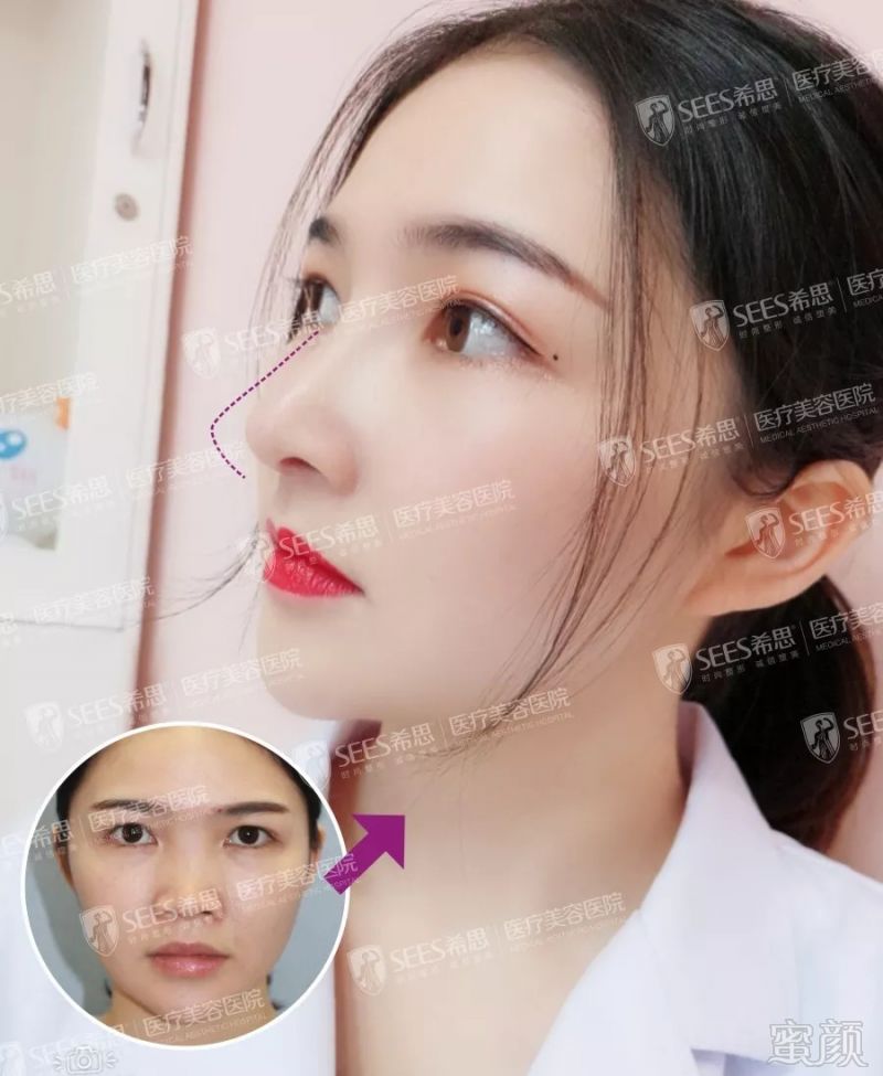https://img.miyanlife.com/mnt/timg/180902/123Q54K8-6.jpg