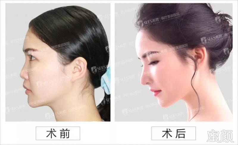 https://img.miyanlife.com/mnt/timg/180902/123QB612-7.jpg