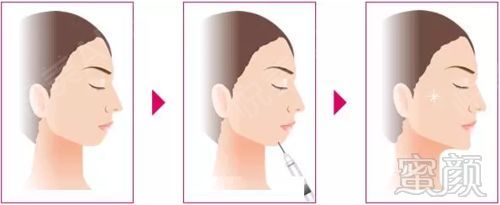 https://img.miyanlife.com/mnt/timg/180903/1050433004-6.jpg