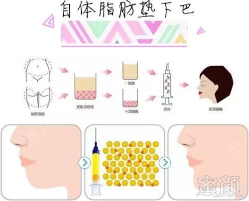 https://img.miyanlife.com/mnt/timg/180903/1050433Q3-7.jpg