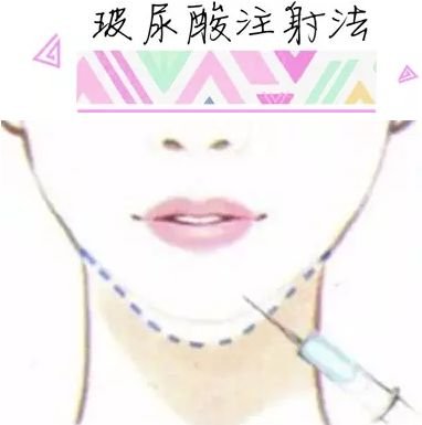 https://img.miyanlife.com/mnt/timg/180903/1050435333-5.jpg