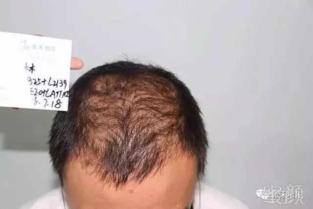 https://img.miyanlife.com/mnt/timg/180903/10561961c-3.jpg