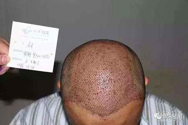 https://img.miyanlife.com/mnt/timg/180903/1056203433-5.jpg