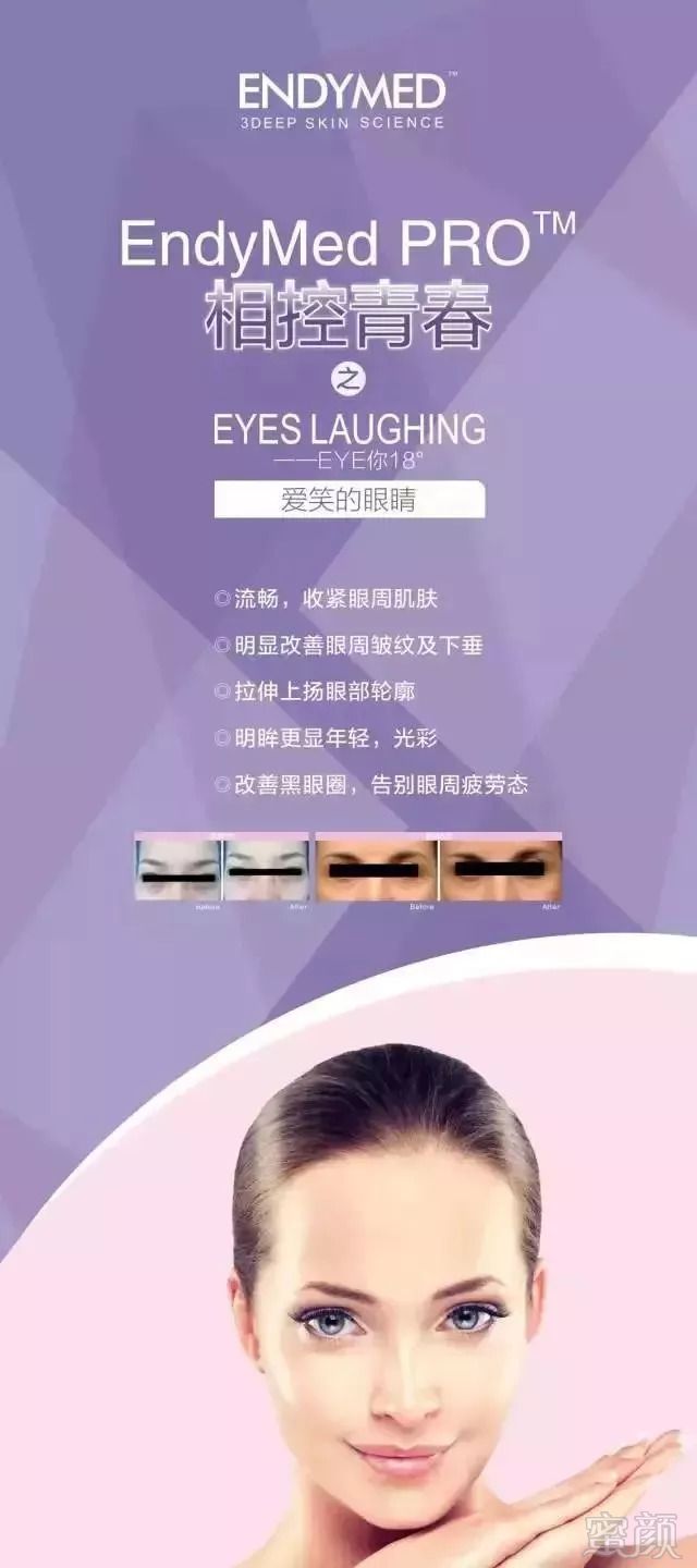 https://img.miyanlife.com/mnt/timg/180903/11014641Z-8.jpg