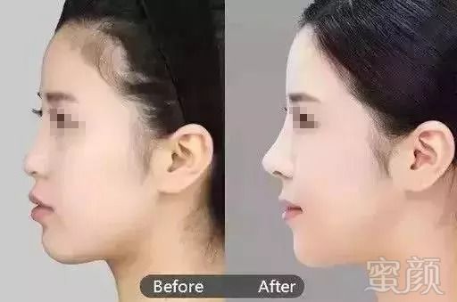 https://img.miyanlife.com/mnt/timg/180903/11322A457-2.jpg