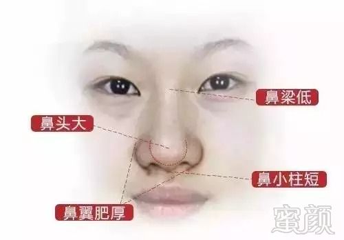 https://img.miyanlife.com/mnt/timg/180903/11322HZ6-3.jpg