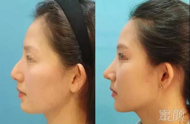 https://img.miyanlife.com/mnt/timg/180903/11322I124-6.jpg