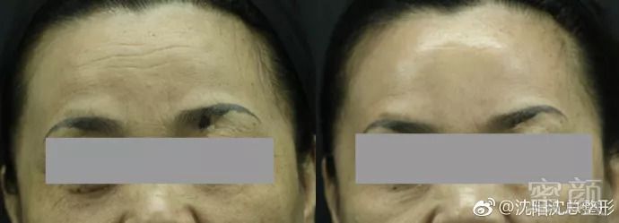 https://img.miyanlife.com/mnt/timg/180903/1145453096-0.jpg