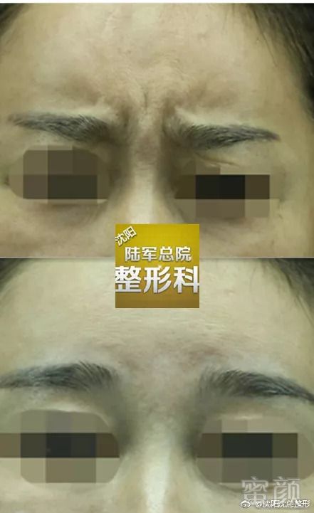 https://img.miyanlife.com/mnt/timg/180903/1145454103-1.jpg