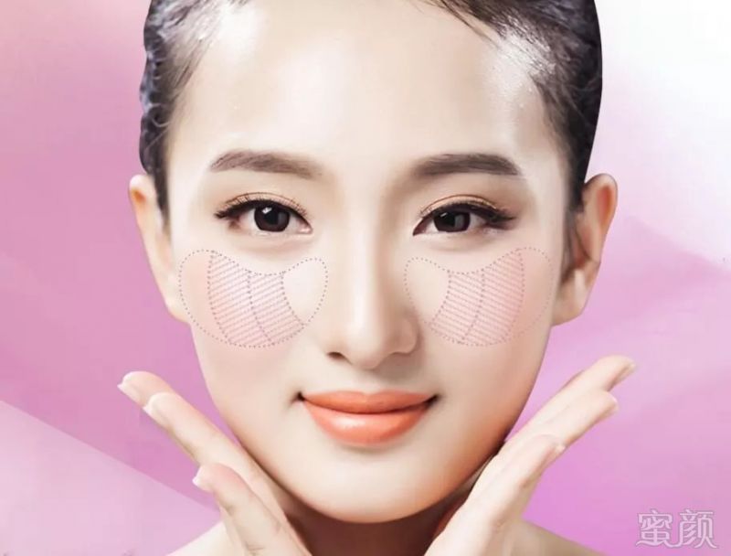 https://img.miyanlife.com/mnt/timg/180903/115Z14529-3.jpg