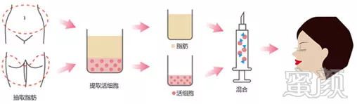 https://img.miyanlife.com/mnt/timg/180903/115Z35461-5.jpg
