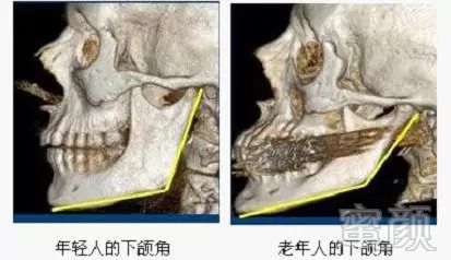 案例图片