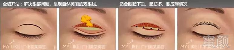 https://img.miyanlife.com/mnt/timg/180903/1224552G4-0.jpg