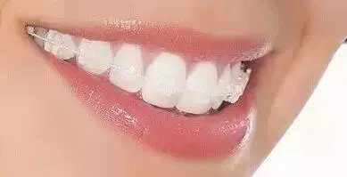 https://img.miyanlife.com/mnt/timg/180903/122A53433-3.jpg