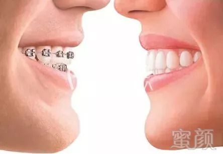https://img.miyanlife.com/mnt/timg/180903/122A55325-2.jpg