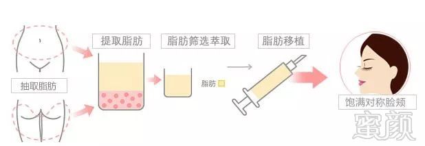 https://img.miyanlife.com/mnt/timg/180903/124T96451-1.jpg