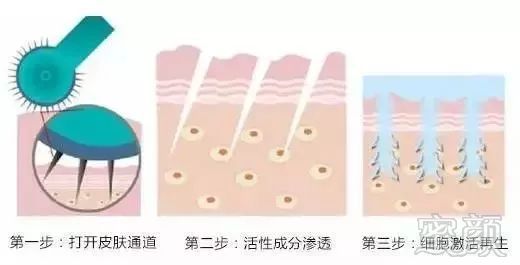 https://img.miyanlife.com/mnt/timg/180903/1251151459-2.jpg