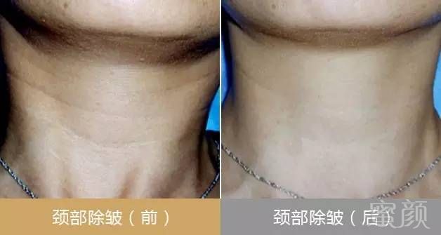 https://img.miyanlife.com/mnt/timg/180903/12511532K-1.jpg
