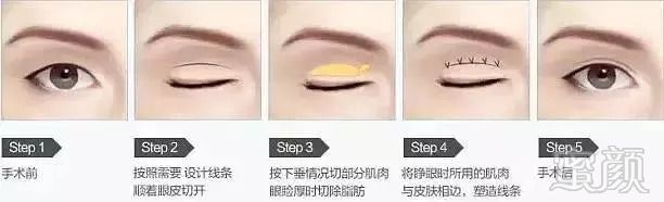 https://img.miyanlife.com/mnt/timg/180903/125301Nb-3.jpg