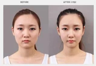 https://img.miyanlife.com/mnt/timg/180903/1303323249-0.jpg