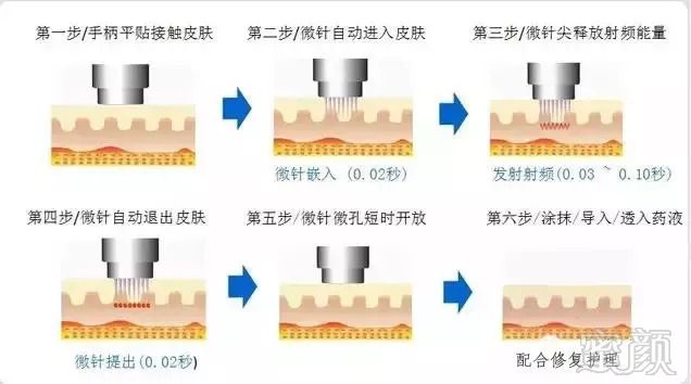 案例图片