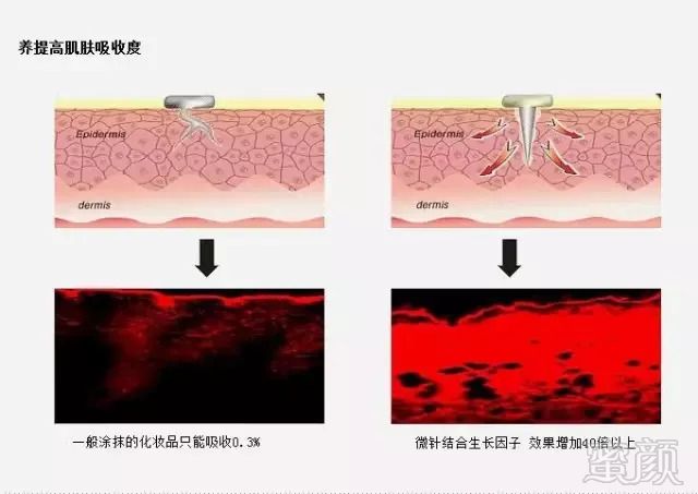 案例图片