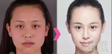 https://img.miyanlife.com/mnt/timg/180904/10345TE4-7.jpg