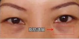 https://img.miyanlife.com/mnt/timg/180904/1053151Z3-7.jpg