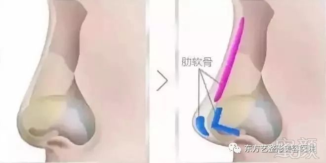 https://img.miyanlife.com/mnt/timg/180904/10591414B-4.jpg