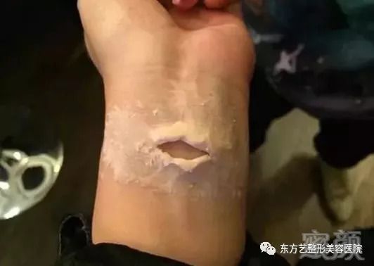 https://img.miyanlife.com/mnt/timg/180904/105Z93116-1.jpg