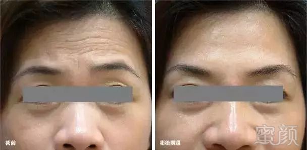 https://img.miyanlife.com/mnt/timg/180904/1110596346-2.jpg