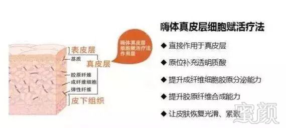 https://img.miyanlife.com/mnt/timg/180904/1122103607-3.jpg