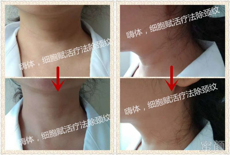https://img.miyanlife.com/mnt/timg/180904/1122105306-4.jpg