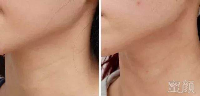 https://img.miyanlife.com/mnt/timg/180904/1130091Y9-3.jpg