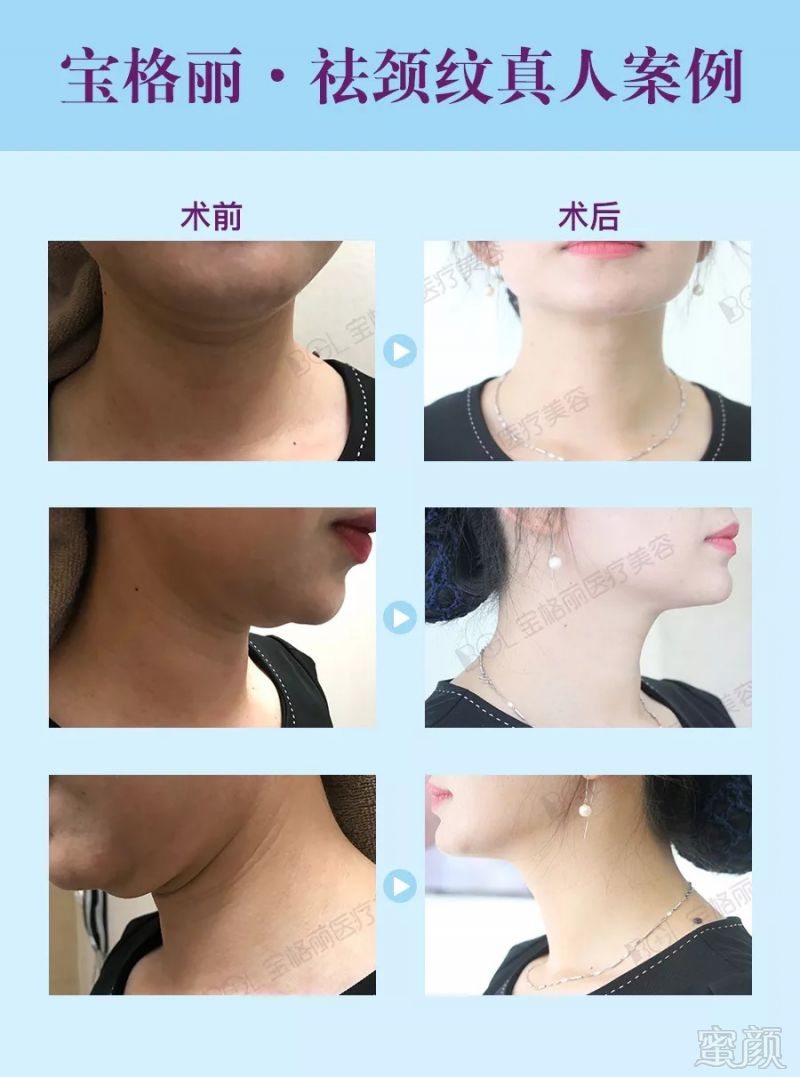 https://img.miyanlife.com/mnt/timg/180904/1130103355-5.jpg