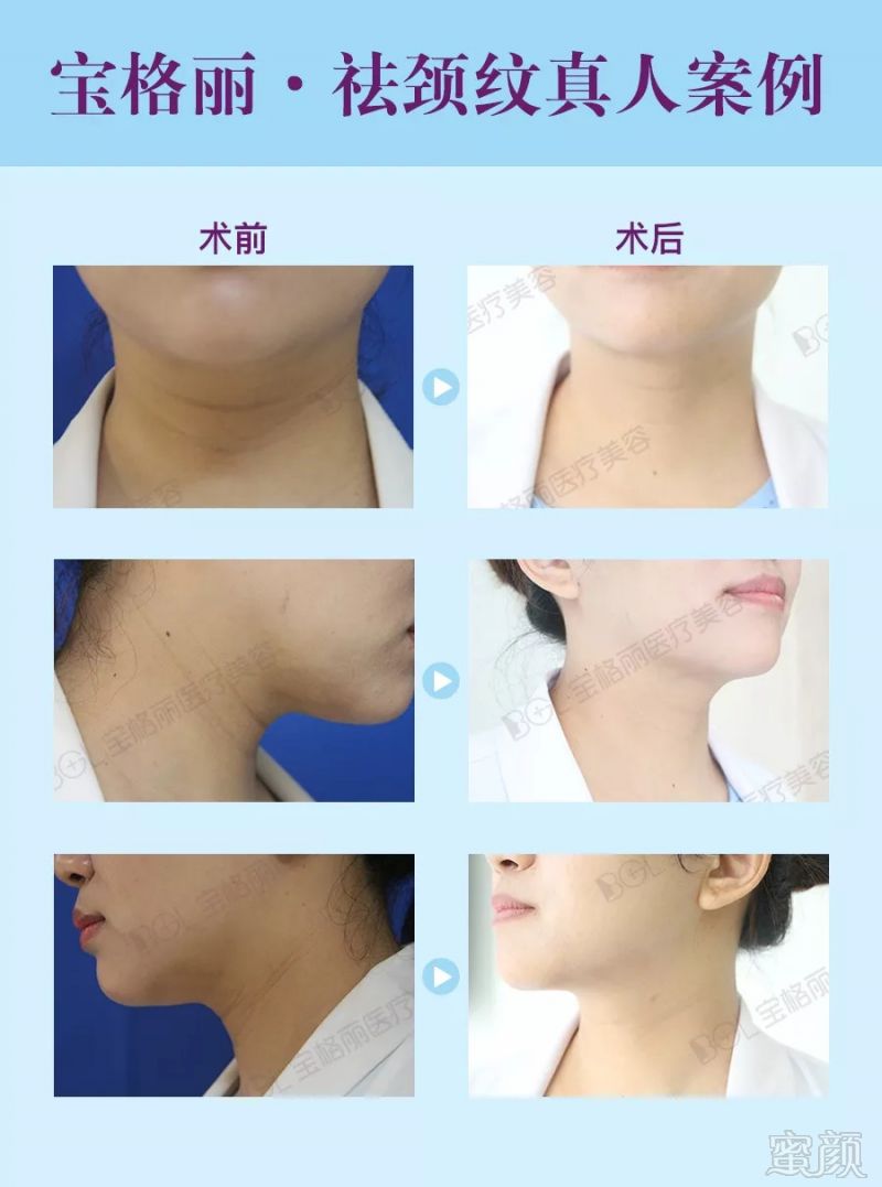 https://img.miyanlife.com/mnt/timg/180904/11301115P-6.jpg
