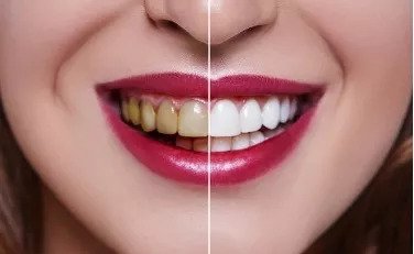 https://img.miyanlife.com/mnt/timg/180904/11504I027-2.jpg