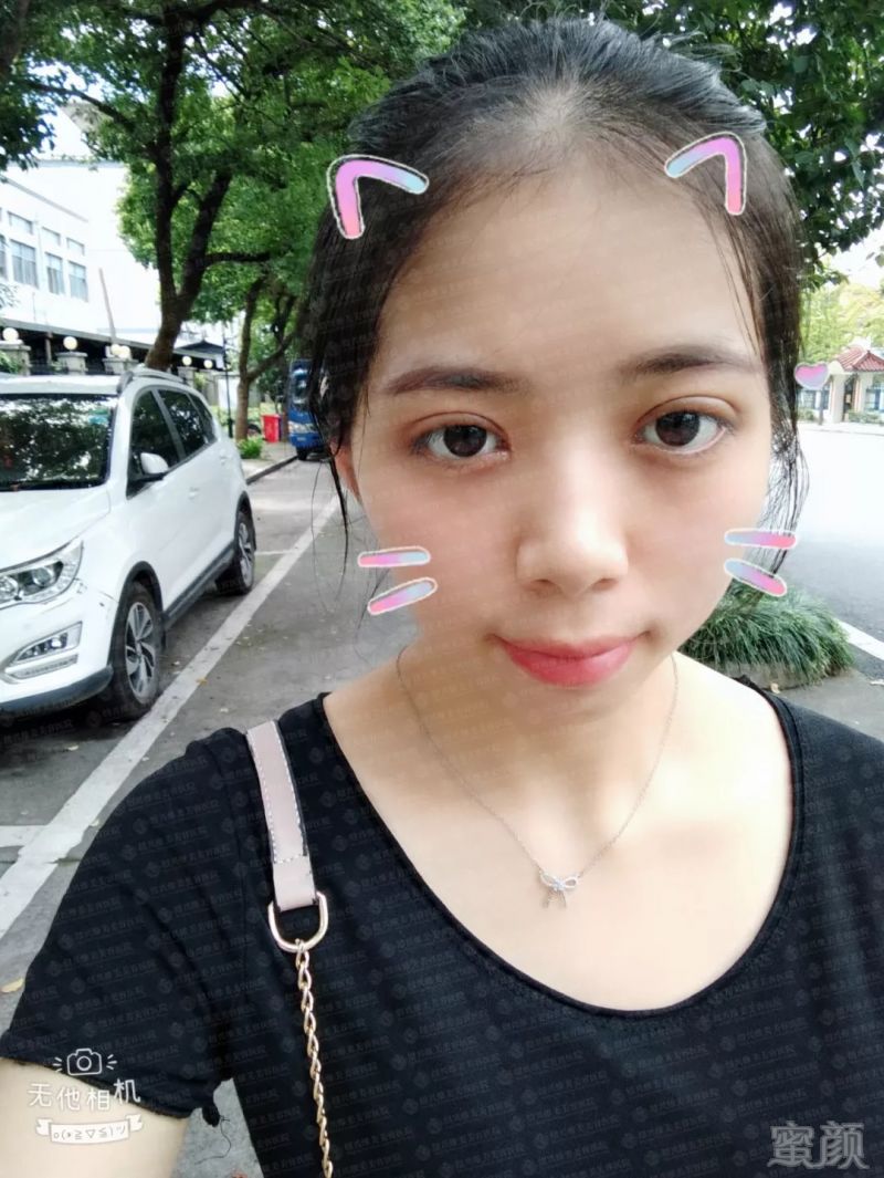 https://img.miyanlife.com/mnt/timg/180904/1156013c2-5.jpg