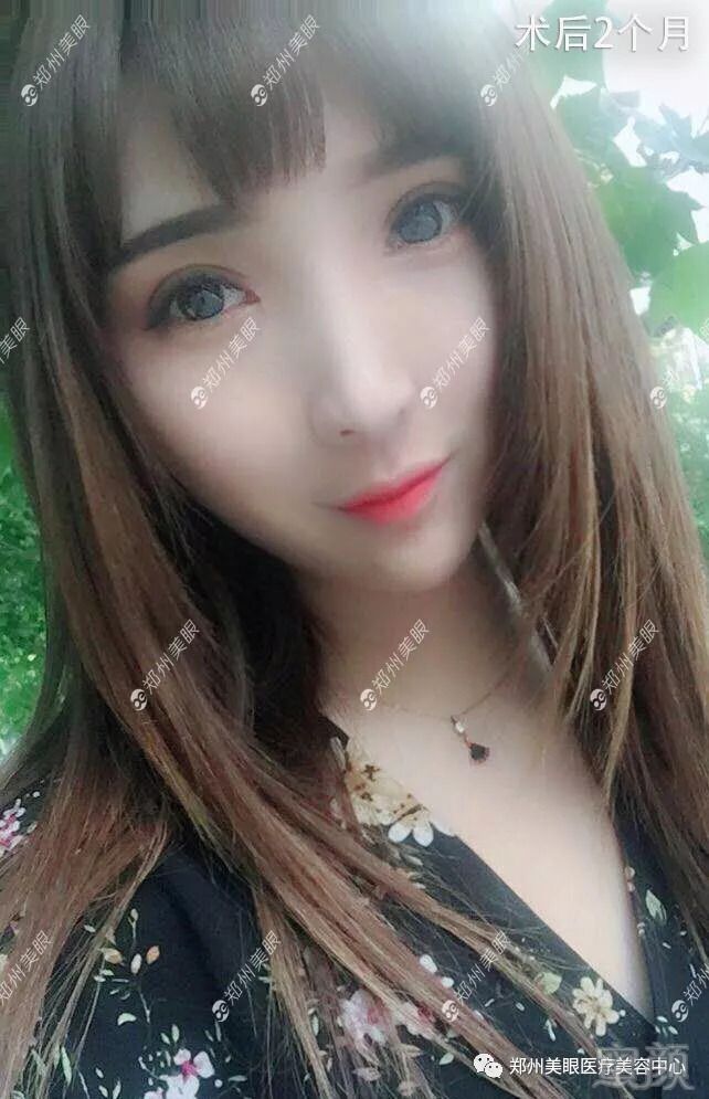 https://img.miyanlife.com/mnt/timg/180904/1202196407-1.jpg