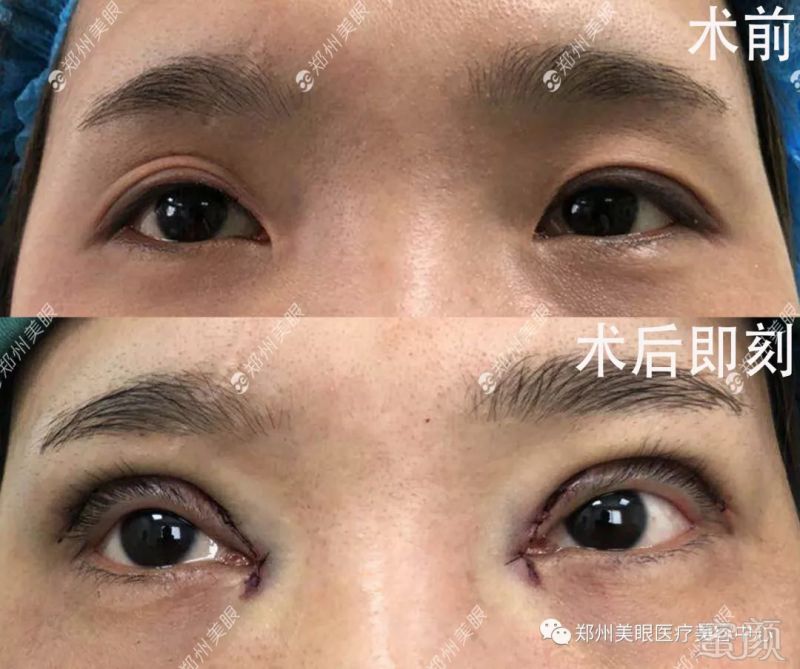 https://img.miyanlife.com/mnt/timg/180904/12021K2a-0.jpg