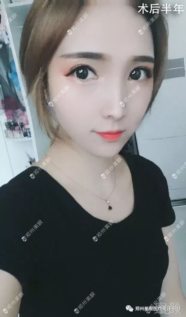 https://img.miyanlife.com/mnt/timg/180904/1202251433-7.jpg