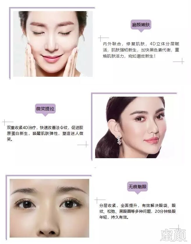https://img.miyanlife.com/mnt/timg/180904/12330260A-2.jpg