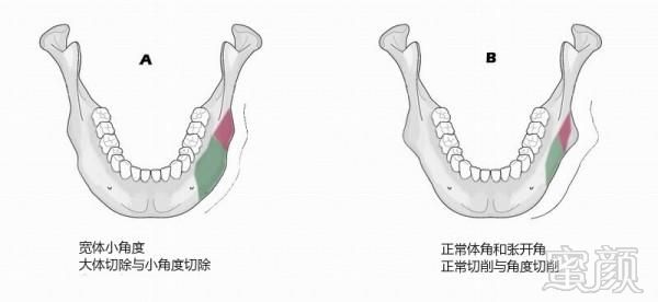 案例图片